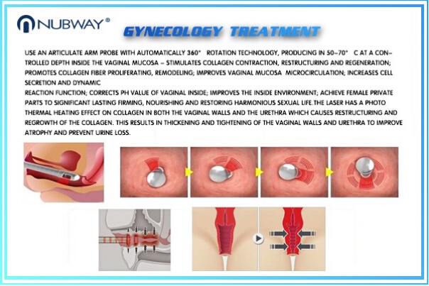 30w Fractional Co2 Laser Nubway Products Vaginal Applicator