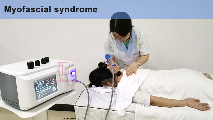 Extracorporeal Shock Wave Therapy Machine For Erectile Dysfunction Shockwave Acoustic Device
