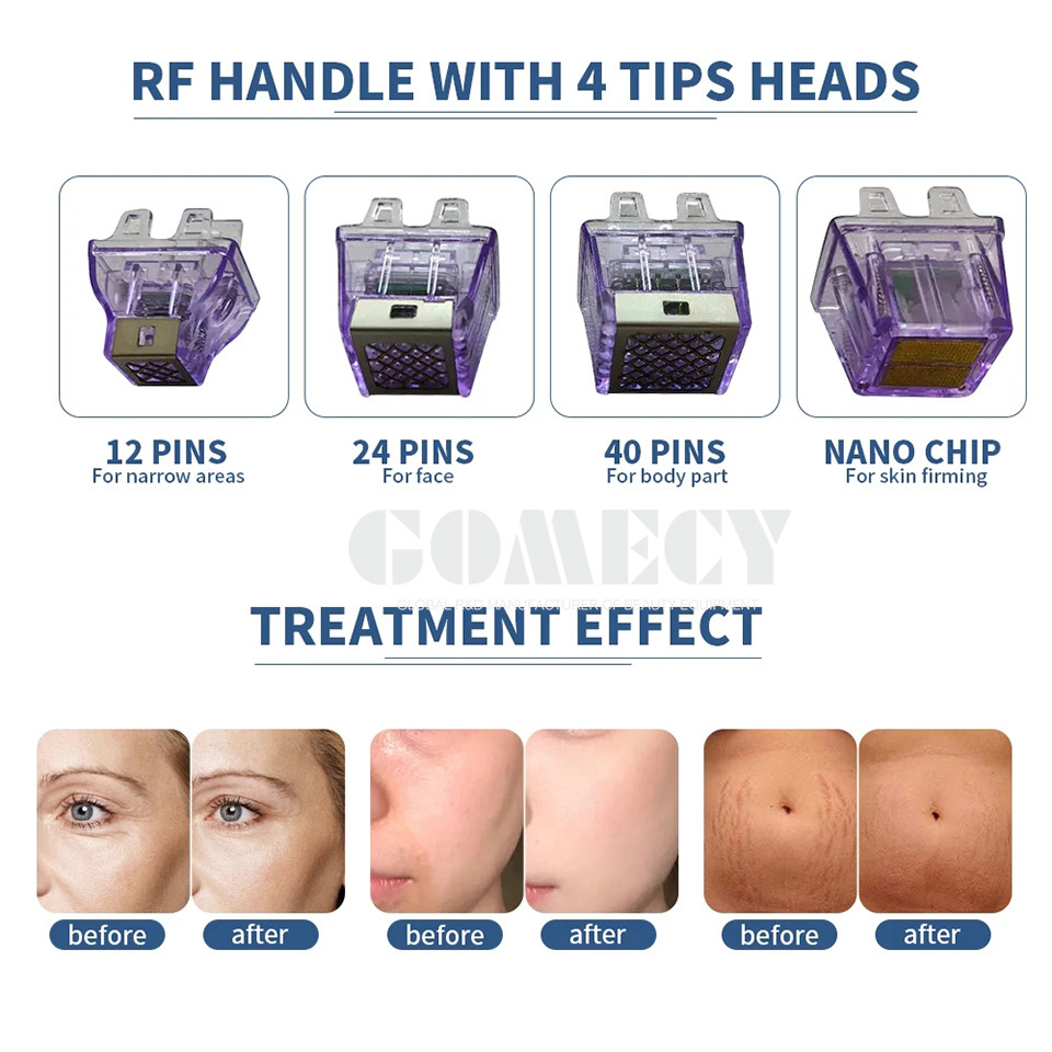 2024 3 In 1 Inmode Morpheus 8 Body Slimming Beauty Machine Radio Frequency Equipment RF Skin Tightening Machine