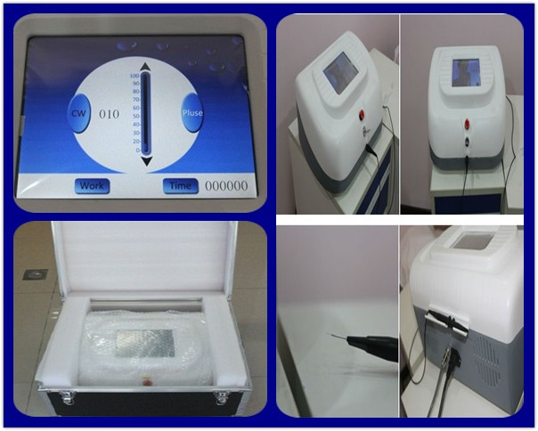 500W Touch high frequency spider veins removal machine for sale for Blood Vessel Removal