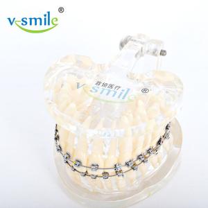 China Stainless Steel MBT Orthodontic Metal Brackets 0.022'' 0.018'' wholesale