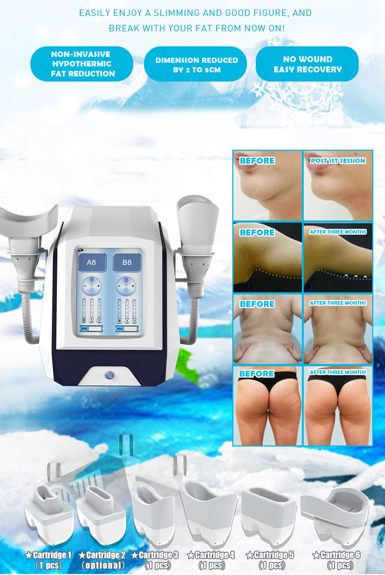 CE FDA Portable Cryolipolysis 110V/220V Body Slimming Fat Freezing Machine