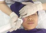 Noninvasive Weight Loss 10 Pins Microneedling Rf Machine