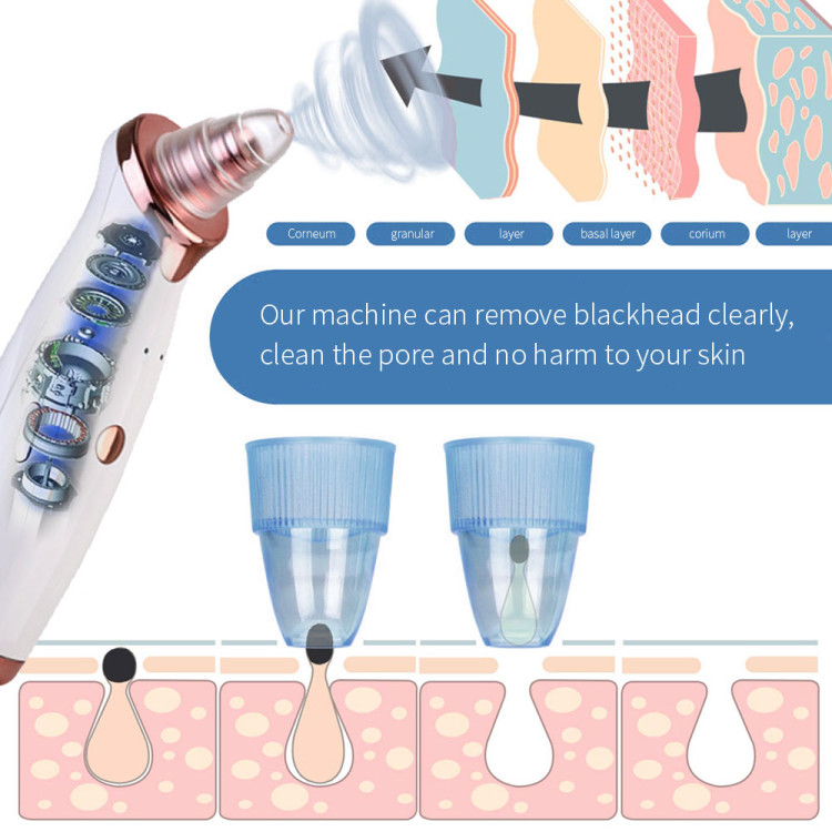 Pore Cleaner Extractor De Espinillas Productos De Belleza Blackhead Remover Vacuum
