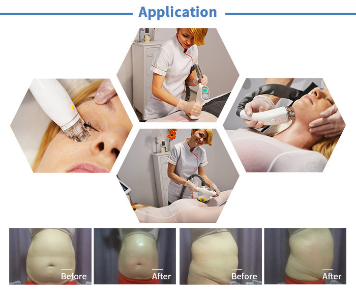 Three Handles Cellulite Cavitation Machine , RF Slimming Machine 110V-240V