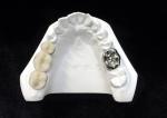 Ultra Hard Digital Porcelain Dental Crown Health Safety High Density