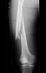 Medical Digital X Ray Dry Film , Dt2b / Dt1b Agfa Medical Dry Imaging Film