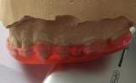 Michigan Guard Trushine Bite Plane For Teeth Grinding