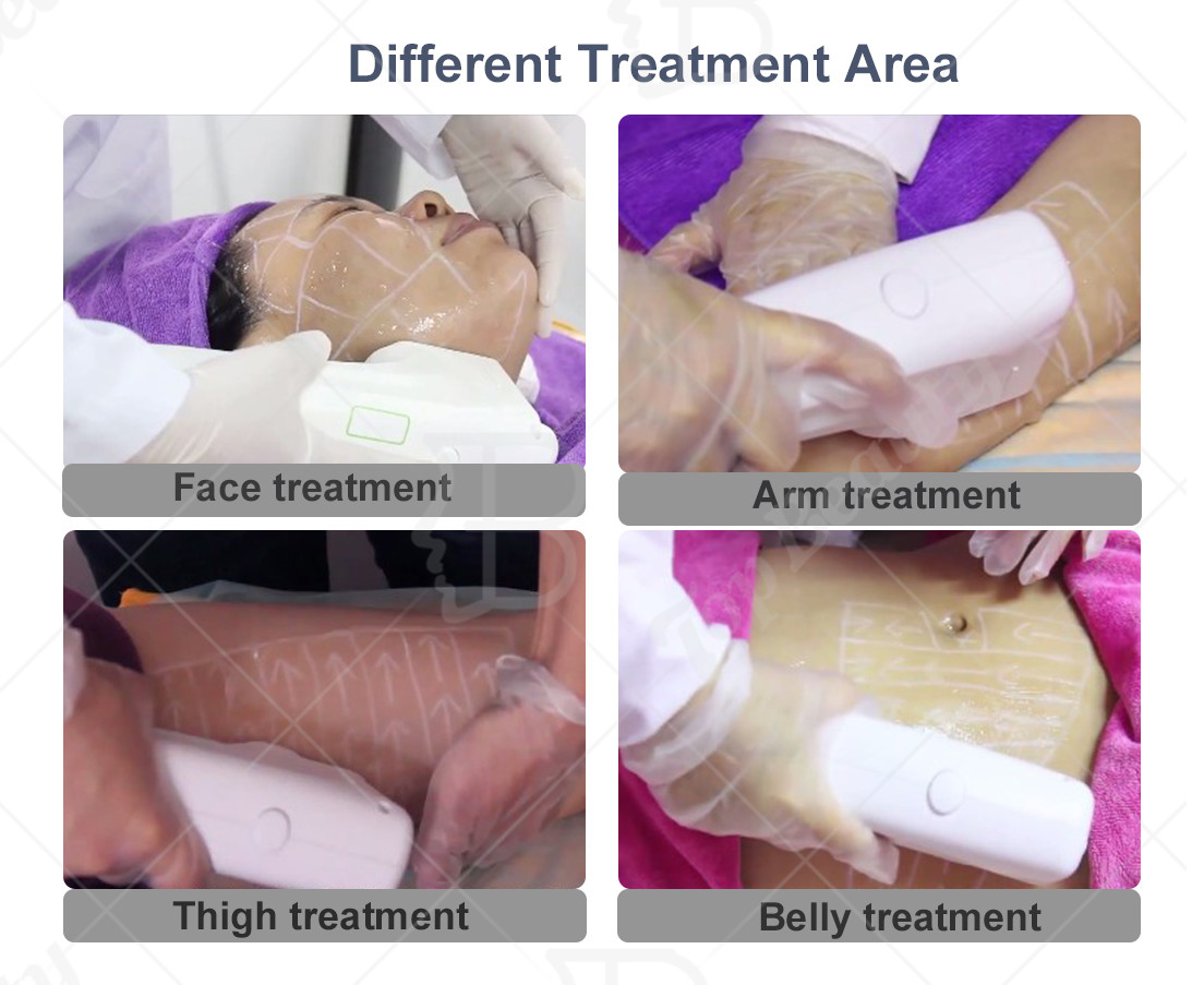 3D HIFU Facial Machine Y Corporal Skin Tightening Face Lift 4d Hifu Device