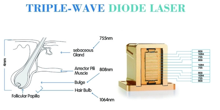 painless hair removal 808nm medical diode laser hair removal machine for sale