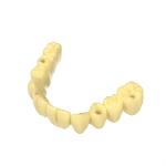 Transparent Biocompatible Resin Temporary Restorations Dental Resin 3d