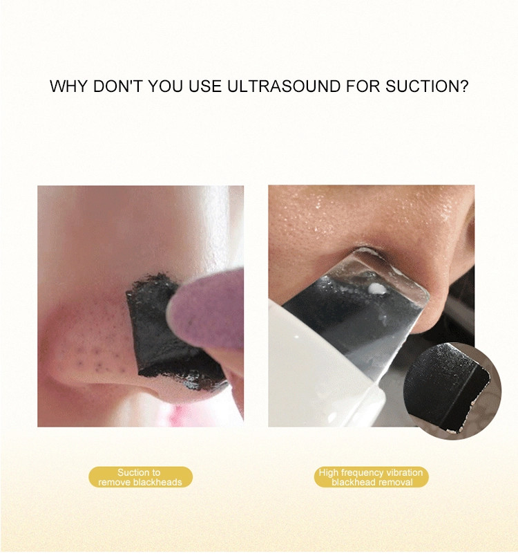 CE ROHS Handheld Acoustic Pulse Ultrasonic Skin Scrubber