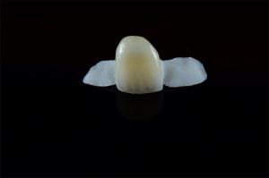 China Customized Dental Resin-bonded Maryland bridge wholesale