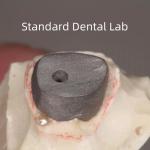 Dental Restoration Metal Post And Core Crown Perfect Fit