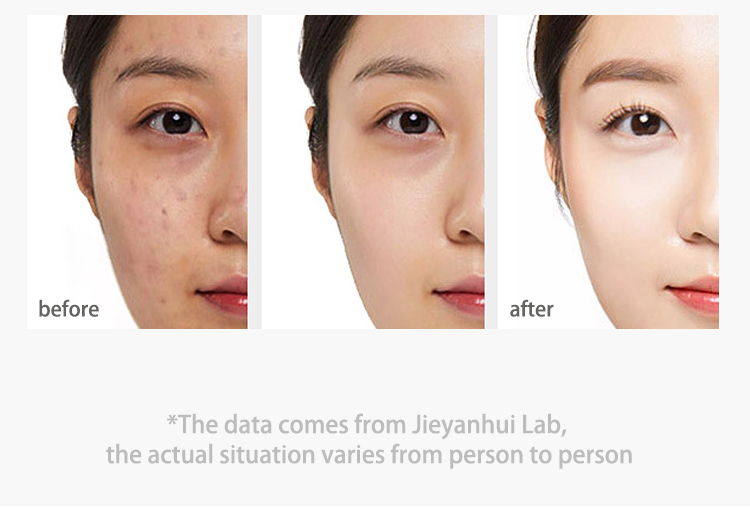 60g Herbal Mint Cool Moisturizer Facial Cream Remove Scars Anti Acne