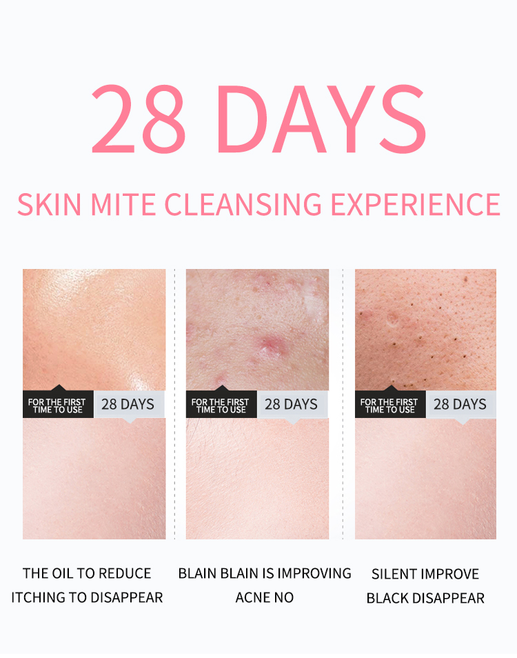 OEM Skincare 120ml Foaming Facial Cleanser Blackhead Remover Face Wash