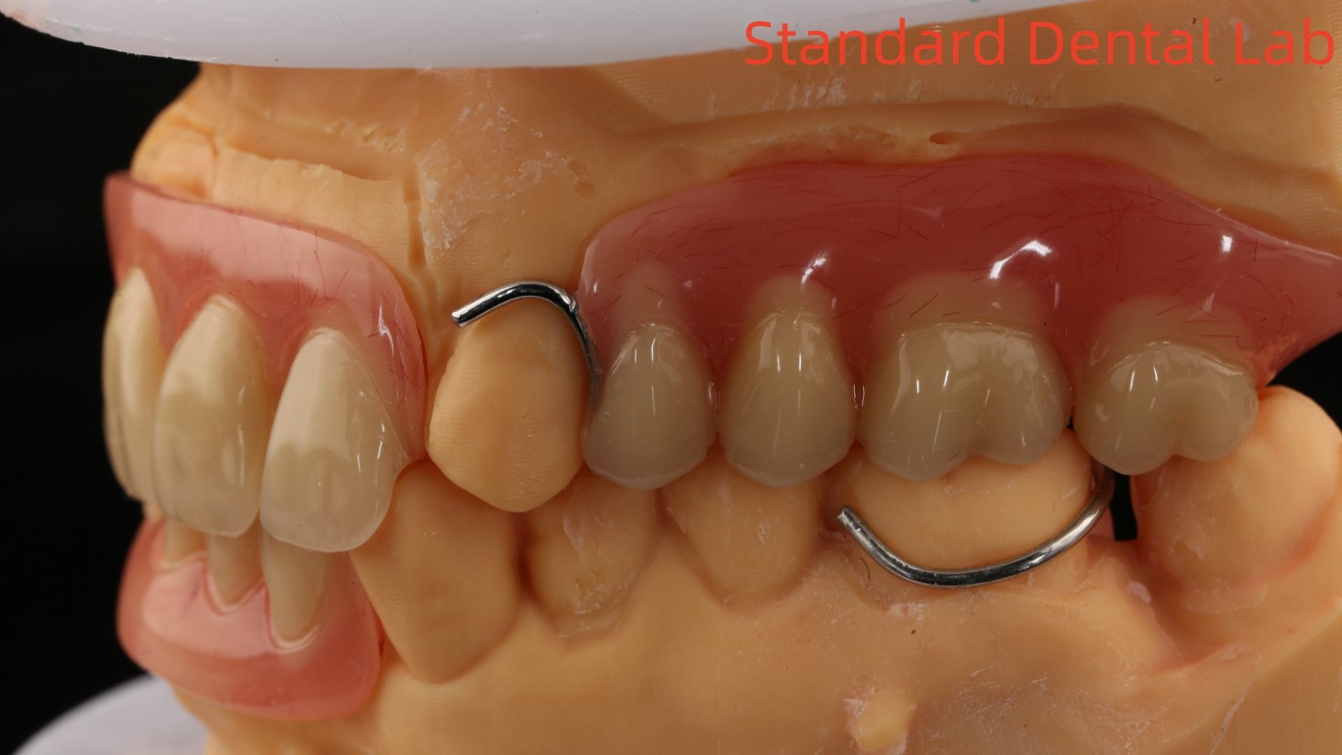 Heat Cured Ivoclar Partial Acrylic Denture Dental Lab High Accuracy with 3D print model