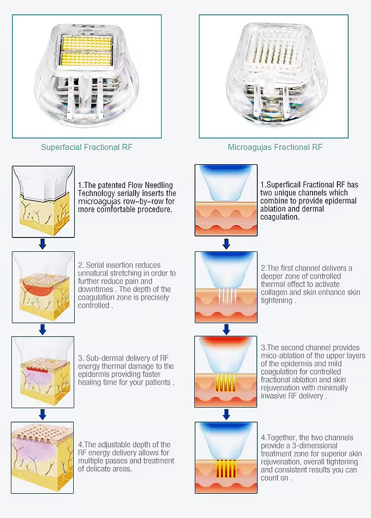 Vacuum Fractional Rf Microneedle Machine For Acne Scars
