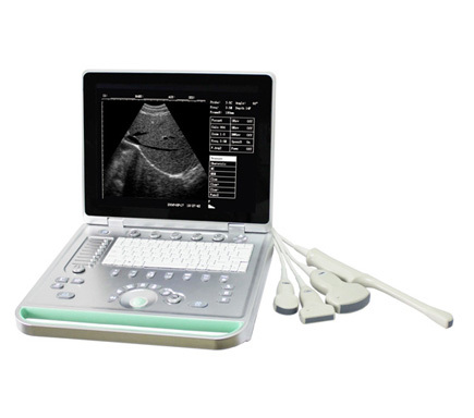 Portable ultrasound machine Laptop Ultrasound machine SU-7S with CE