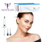 Neofiller 1ml Cross Linked Dermal Filler Hyaluronic Natural Looking Lip