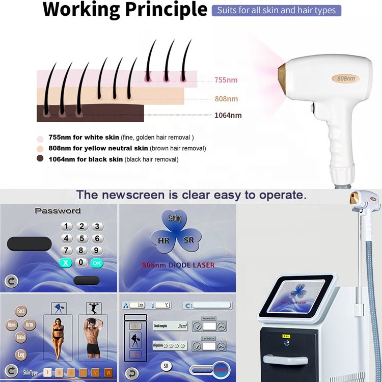 Painless Pro Diode Laser Hair Removal Machine 1064nm 808 Diode Laser Portable