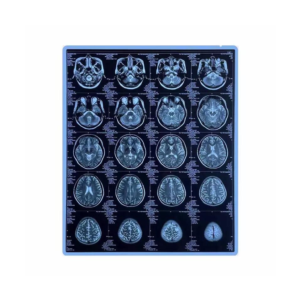Printed Laser X Ray Film Excellent UV Resistance And Good Moisture Resistance
