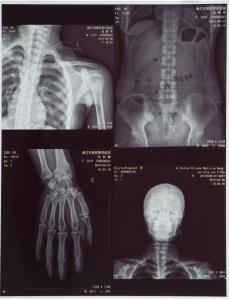China Silver Halide Blue Inkjet Film For Medical Imaging wholesale