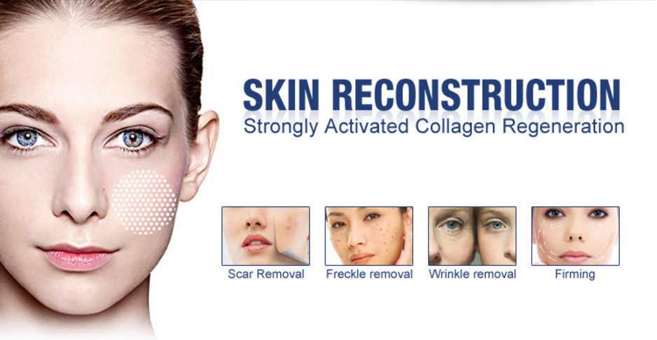 Medical Fractional CO2 Laser For Under Eye Wrinkles / Skin Rejuvenation