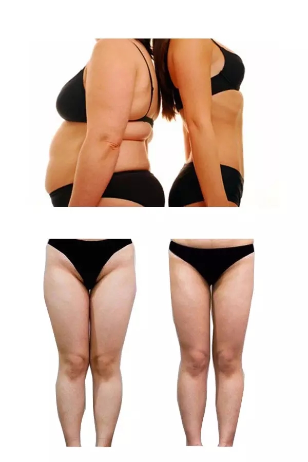 fat results