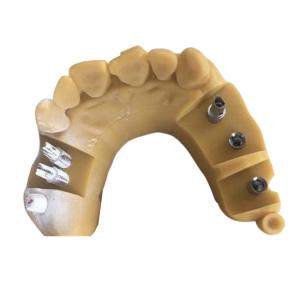 China Digital Biocompatibility PFM Dental Crown 3D Printing Temporary Crowns wholesale