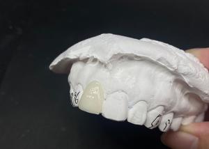 China Translucent Custom Dental Veneers Fast and Effective Solutions for Long-Lasting Smile wholesale