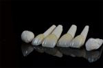 Dental Natural Porcelain Teeth Veneers Feldspathic Veneer 0.5mm-0.7mm