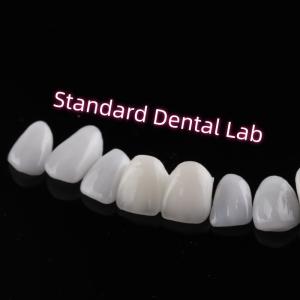 China Abrasion Resistant Emax Zirconia Laminate Veneers Incisal Translucency wholesale