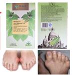 Herbal gout treatment Chinese gout relief tea teabag podagra big toe medication