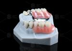 Silver Key And Keyway Attachment Easy Maintenance Precision Attachment Dental