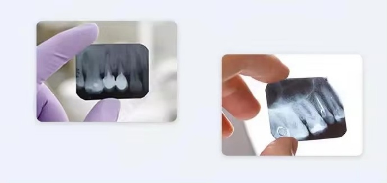 Light Weight Dental X-Ray Digital Machine Low Radiation Portable Dental X-Ray Machine