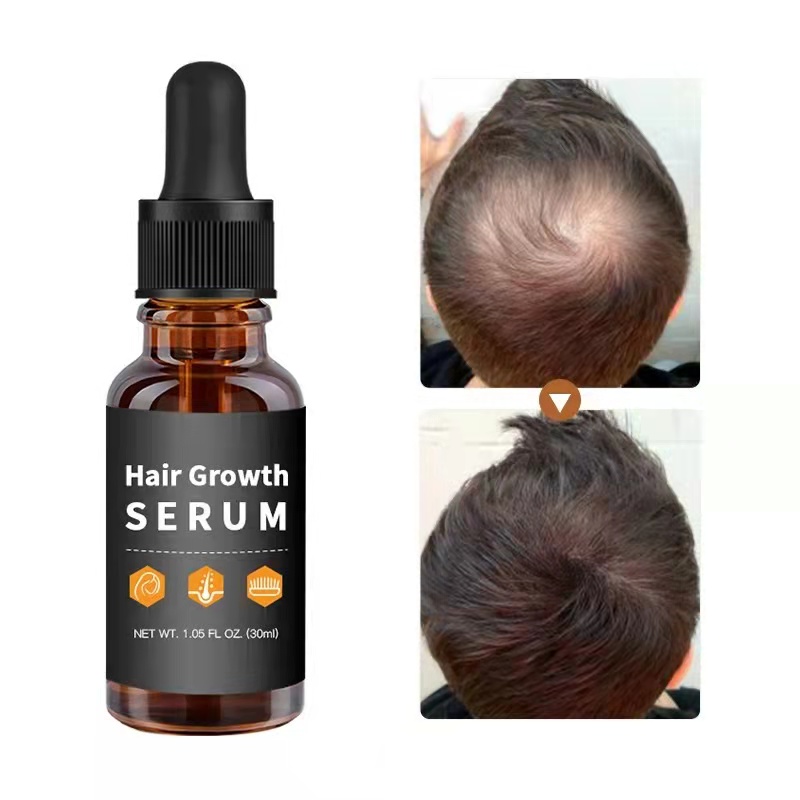 Customization Hair Growth Treatment Serum for Black Women Private Label