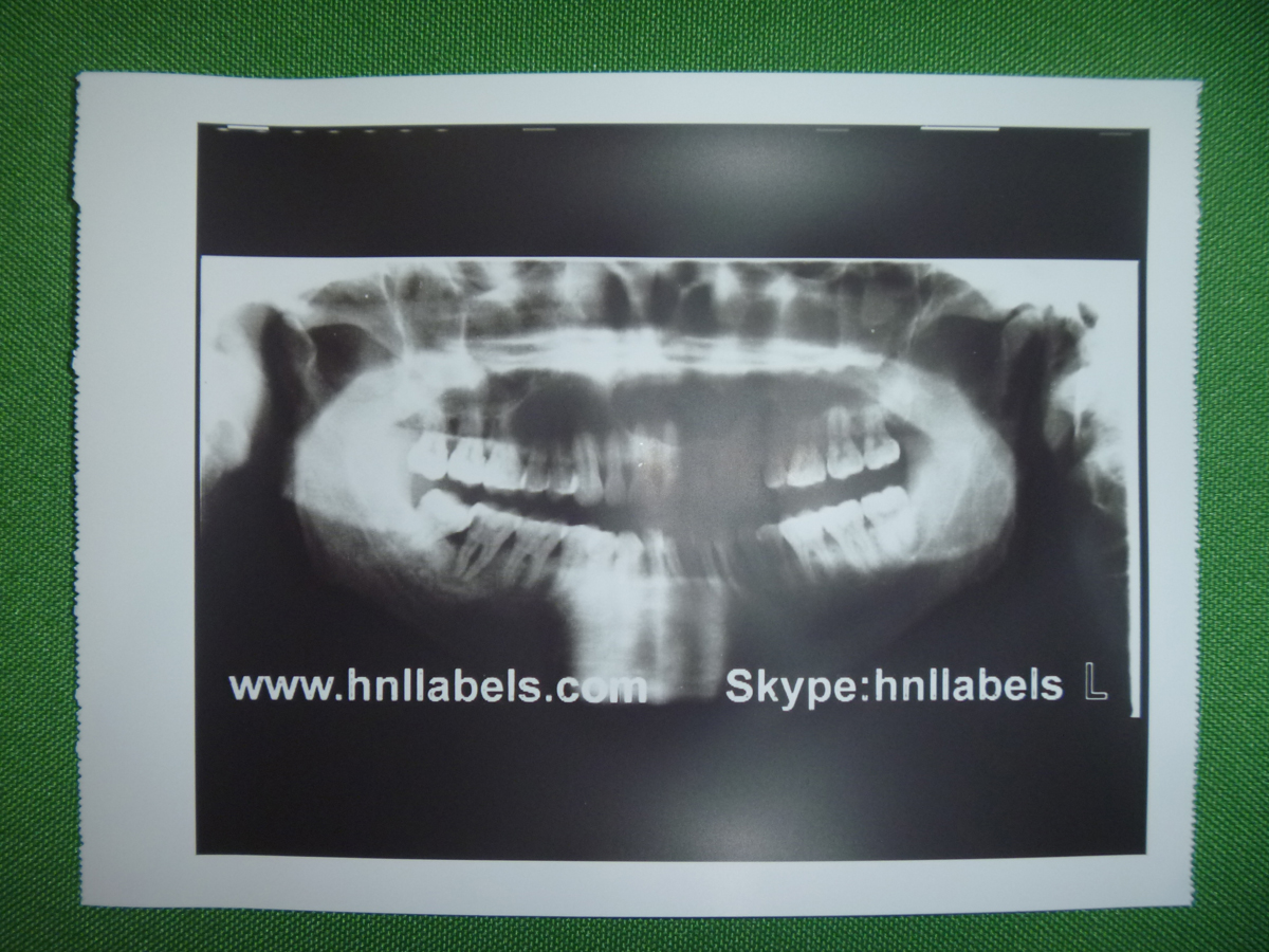 upp-110s,sony ultrasound paper, sony upp-110s