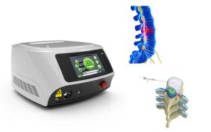 China Painless Percutaneous Laser Disk Decompression Cherylas 1470nm wholesale