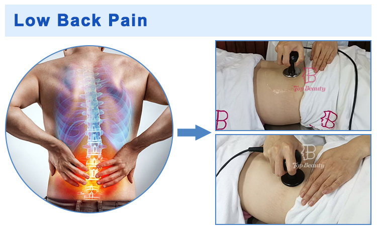 Resistive Rf Tecar Therapy Machine Sports Rehabilitation