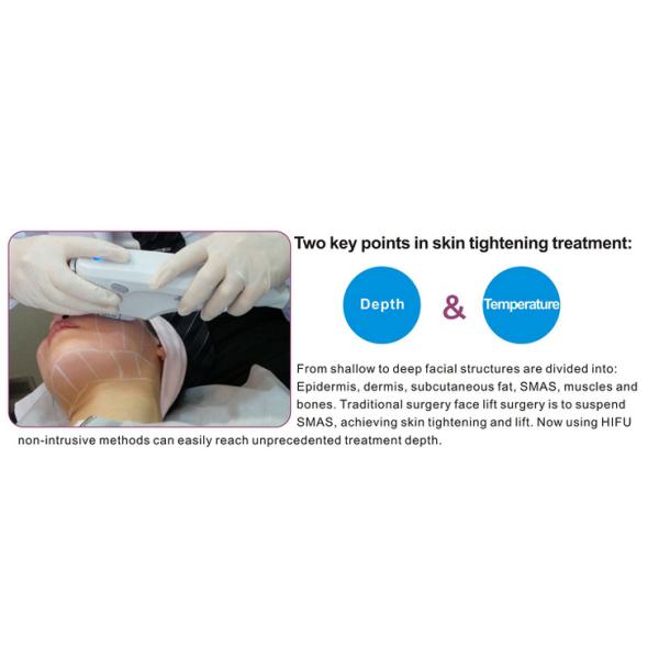 0.1-2J Energy Hifu High Intensity Focused Ultrasound Machine With 5 Treatment Heads