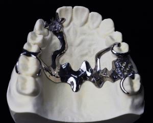 China Cr Co Partial Denture Metal Framework wholesale