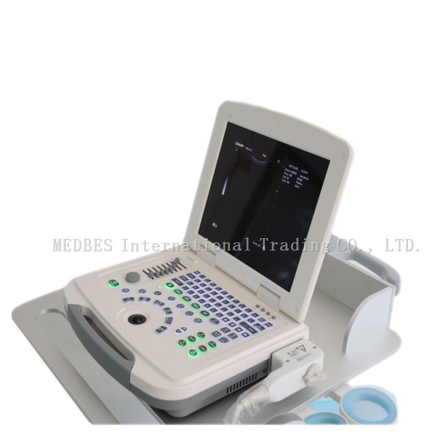 Clinic 80 elements Laptop Ultrasound Machine B580 with Battery