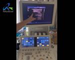 IE33 Ultrasound Machine Repair Small Parts Probe Image Loss