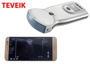 China Low Price Wireless Ultrasound Probe Mobile Gyne Ultrasound Machine wholesale
