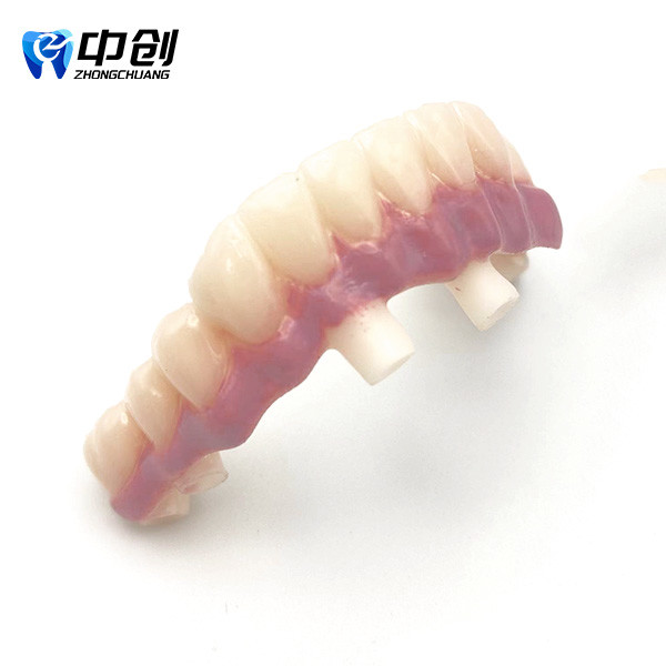 Highly Radiopaque Pink Opaque 4 Color Aesthetic Resin for Professional Natural Restoration