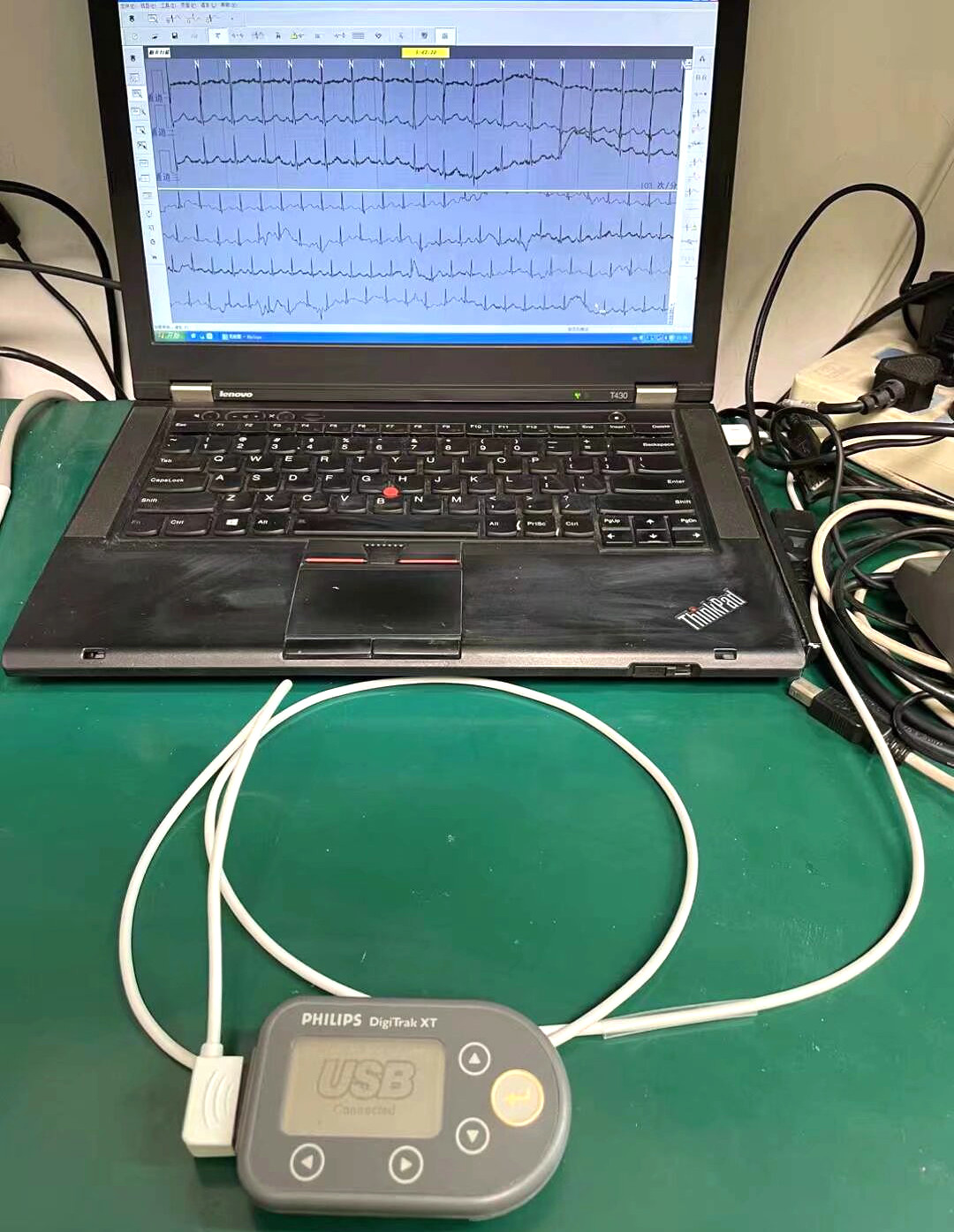 Philip DigiTrak XT Dynamic ECG Box Maintenance，Philip Patient Monitor Maintenance