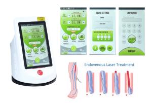 China 810nm 980nm Medical Laser Machine Local Anesthesia EVLT wholesale