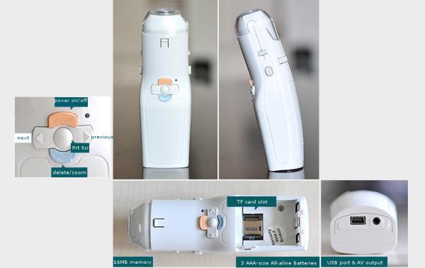 High Definition Echo - Digital Electronic Colposcope Gynaecologic Apparatus