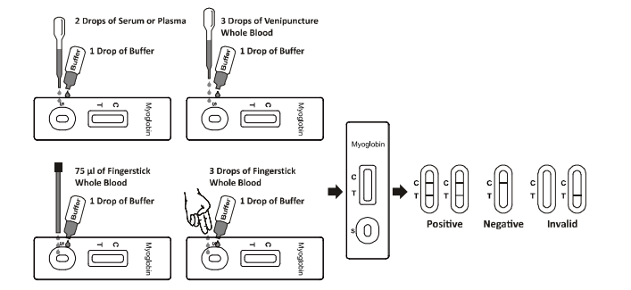 Citest CMY-R402 Myoglobin Rapid Test LF Reader Semi Quantitative
